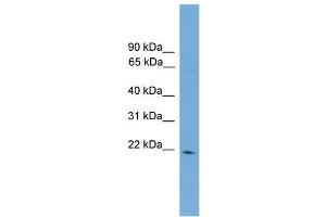 Human COLO205; WB Suggested Anti-D4S234E Antibody Titration: 0. (NSG1 抗体  (N-Term))