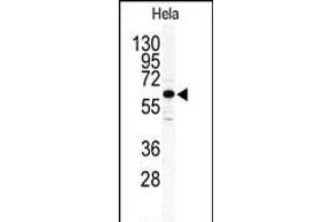 Western blot analysis of anti-ILK2/ILK1 Antibody (C-term) (ABIN391105 and ABIN2837942) in Hela cell line lysates (35 μg/lane). (ILK 抗体  (C-Term))