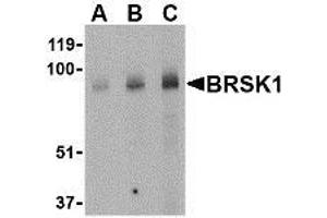 Western blot analysis of BRSK1 in human brain tissue lysate with AP30167PU-N BRSK1 antibody at (A) 0. (BRSK1 抗体  (Center))