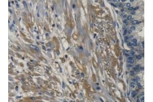 DAB staining on IHC-P; Samples: Human Prostate Tissue (TRAPPC10 抗体  (AA 74-357))