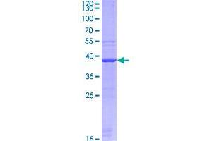 Image no. 1 for Glypican 1 (GPC1) (AA 71-165) protein (GST tag) (ABIN2866340)