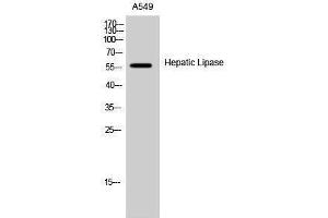 Western Blotting (WB) image for anti-Lipase, Hepatic (LIPC) (Internal Region) antibody (ABIN3175476) (LIPC 抗体  (Internal Region))