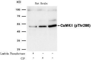 Western blot analysis of extracts from Rat brain tissue treated with Lambda Phosphotase or calf intestinal phosphatase (CIP),using CaMKII (Phospho-Thr286) Antibody. (CAMK2A 抗体  (pThr286))