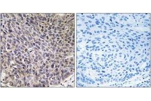 Immunohistochemistry (IHC) image for anti-Cytochrome P450, Family 4, Subfamily B, Polypeptide 1 (CYP4B1) (AA 141-190) antibody (ABIN1534398)