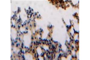 Used in DAB staining on fromalin fixed paraffin-embedded Lung tissue (ESM1 抗体  (AA 20-184))