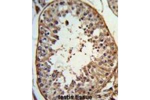 Immunohistochemistry (IHC) image for anti-Angel Homolog 1 (ANGEL1) antibody (ABIN3003977) (ANGEL1 抗体)
