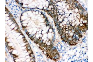 Immunohistochemistry (Paraffin-embedded Sections) (IHC (p)) image for anti-Isocitrate Dehydrogenase 1 (NADP+), Soluble (IDH1) (AA 381-413), (C-Term) antibody (ABIN3043855) (IDH1 抗体  (C-Term))