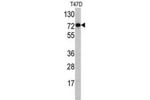 Western blot analysis of PID/MTA2 antibody (C-term) in T47D cell line lysates (35ug/lane). (MTA2 抗体  (C-Term))