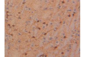 DAB staining on IHC-P; Samples: Rat Glioma Tissue (TIMP4 抗体  (AA 40-224))