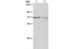 Western Blot analysis of A375 and A431 cell using SH-PTP1 Polyclonal Antibody at dilution of 1:500 (SHP1 抗体)