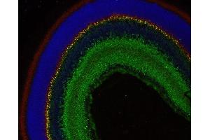 Indirect immunostaining of paraffin embedded mouse retina section with anti-complexin 4 (dilution 1 : 200; red) and rabbit anti-complexin 3 (cat. (Complexin 4 抗体)