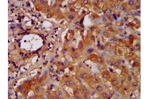 IHC image of ABIN7155245 diluted at 1:200 and staining in paraffin-embedded human liver tissue performed on a Leica BondTM system. (HAL 抗体  (AA 36-152))