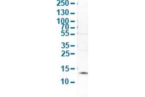 Western Blot analysis of human cell line SK-BR-3. (S100A9 抗体  (AA 3-100))