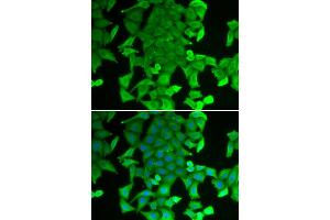 Immunofluorescence analysis of MCF-7 cells using RFFL antibody (ABIN6292254). (RFFL 抗体)