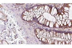 ABIN6272969 at 1/100 staining Mouse colon tissue by IHC-P. (NOD2 抗体  (N-Term))