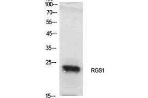 Western Blotting (WB) image for anti-Regulator of G-Protein Signaling 1 (RGS1) (Internal Region) antibody (ABIN3181413) (RGS1 抗体  (Internal Region))