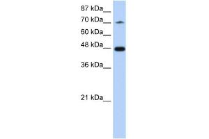 WB Suggested Anti-SF3B4 Antibody Titration:  1. (SF3B4 抗体  (N-Term))