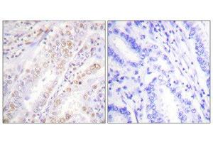Immunohistochemistry (IHC) image for anti-X-Ray Repair Complementing Defective Repair in Chinese Hamster Cells 2 (XRCC2) (C-Term) antibody (ABIN1848896) (XRCC2 抗体  (C-Term))