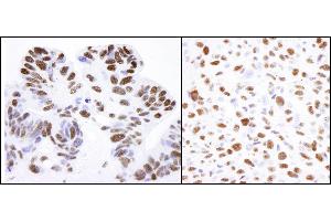 Immunohistochemistry (IHC) image for anti-Nucleolin (NCL) (C-Term) antibody (ABIN7455226)
