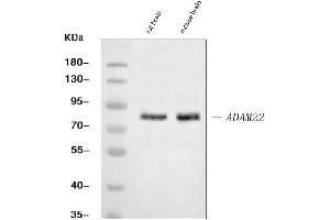 Western blot analysis of ADAM22 using anti-ADAM22 antibody (ABIN7600714).