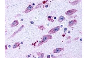 Immunohistochemical staining of Brain (Neurons and glia) using anti- DRD4 antibody ABIN122473 (DRD4 抗体  (C-Term))