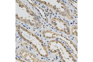 Immunohistochemistry of paraffin-embedded human kidney using EIF4E antibody at dilution of 1:200 (x400 lens) (EIF4E 抗体  (AA 1-100))