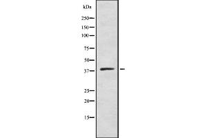 Western blot analysis of DHHC-9 using COLO205 whole cell lysates (ZDHHC9 抗体  (C-Term))