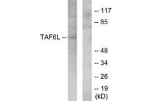 Western blot analysis of extracts from 293 cells, using TAF6L Antibody. (TAF6L 抗体  (AA 31-80))