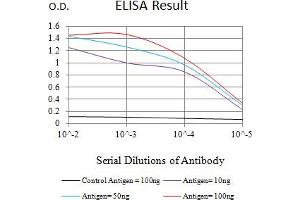 Black line: Control Antigen (100 ng),Purple line: Antigen (10 ng), Blue line: Antigen (50 ng), Red line:Antigen (100 ng) (ZAP70 抗体  (AA 169-390))