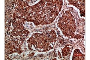 Immunohistochemistry (IHC) image for anti-IMP3, U3 Small Nucleolar Ribonucleoprotein (IMP3) (AA 135-184) antibody (ABIN7189445)
