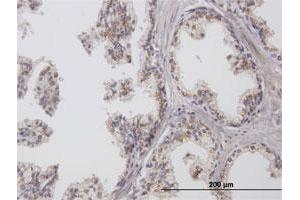 Immunoperoxidase of purified MaxPab antibody to ChGn on formalin-fixed paraffin-embedded human prostate. (CSGALNACT1 抗体  (AA 1-297))