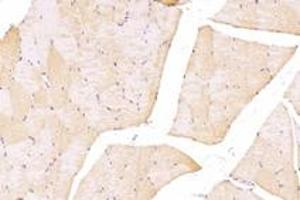Immunohistochemistry analysis of paraffin-embedded rat skeletal muscle using,TTL (ABIN7076048) at dilution of 1: 4000 (TTL 抗体)