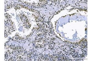 IHC analysis of FOXK1 using anti-FOXK1 antibody (ABIN7600295).