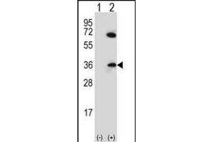 Western blot analysis of CDCA8 (arrow) using rabbit polyclonal CDCA8 Antibody (N-term) (ABIN656687 and ABIN2845924). (CDCA8 抗体  (N-Term))