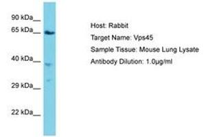Image no. 1 for anti-Vacuolar Protein Sorting 45 (VPS45) (AA 468-517) antibody (ABIN6750334) (VPS45 抗体  (AA 468-517))