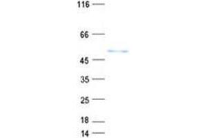 Western Blotting (WB) image for Centrosomal Protein 44kDa (CEP44) protein (His tag) (ABIN5505591)