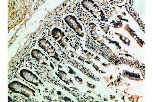 Immunohistochemical analysis of paraffin-embedded Human-colon, antibody was diluted at 1:100 (NFAT1 抗体  (AA 640-700))