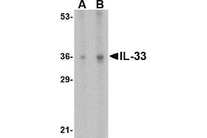 Western blot analysis of IL-33 in human lymph node tissue lysate with AP30426PU-N IL-33 antibody at (A) 1 and (B) 2 μg/ml. (IL-33 抗体  (N-Term))