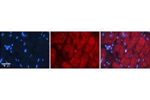 Rabbit Anti-Six1 Antibody    Formalin Fixed Paraffin Embedded Tissue: Human Adult heart  Observed Staining: Cytoplasmic,Nuclear (very rare in Nuclear) Primary Antibody Concentration: 1:600 Secondary Antibody: Donkey anti-Rabbit-Cy2/3 Secondary Antibody Concentration: 1:200 Magnification: 20X Exposure Time: 0. (SIX Homeobox 1 抗体  (N-Term))