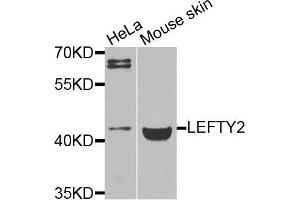 Western blot analysis of extracts of various cells, using LEFTY2 antibody. (LEFTY2 抗体)