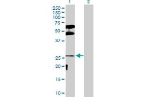 Western Blot analysis of DLX3 expression in transfected 293T cell line by DLX3 MaxPab polyclonal antibody. (DLX3 抗体  (AA 1-287))