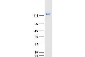 Western Blotting (WB) image for Ubiquitin Specific Peptidase 25 (USP25) protein (Myc-DYKDDDDK Tag) (ABIN2735103)