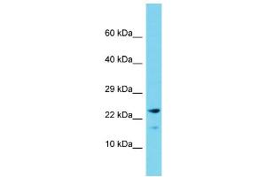 Host: Rabbit Target Name: CNIH2 Sample Type: Fetal Liver lysates Antibody Dilution: 1. (CNIH2 抗体  (C-Term))