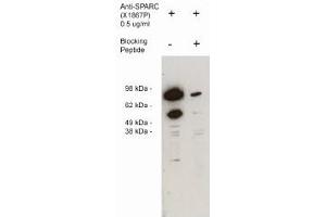 Image no. 1 for anti-Secreted Protein, Acidic, Cysteine-Rich (Osteonectin) (SPARC) antibody (ABIN265179) (SPARC 抗体)