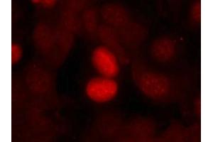 Immunofluorescence staining of methanol-fixed MCF7 cells using FKHR(Phospho-Ser256) Antibody. (FOXO1 抗体  (pSer256))
