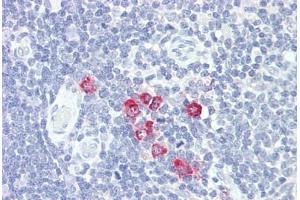 Anti-GlcNAc6ST2 / CHST4 antibody IHC staining of human thymus. (CHST4 抗体  (AA 234-283))