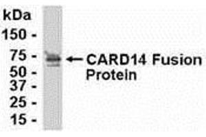 Western Blotting (WB) image for anti-Caspase Recruitment Domain Family, Member 14 (CARD14) (AA 221-330) antibody (ABIN2468032) (CARD14 抗体  (AA 221-330))