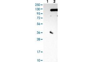 Western Blot (Cell lysate) analysis with SRPK2 polyclonal antibody  Lane 1: Negative control (vector only transfected HEK293T lysate)  Lane 2: Over-expression lysate (Co-expressed with a C-terminal myc-DDK tag (~3. (SRPK2 抗体)