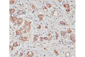Immunohistochemistry (Paraffin-embedded Sections) (IHC (p)) image for anti-Testis Derived Transcript (3 LIM Domains) (TES) antibody (ABIN7263067)