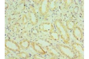 Immunohistochemistry of paraffin-embedded human kidney tissue using ABIN7155971 at dilution of 1:100 (HYAL2 抗体  (AA 367-473))